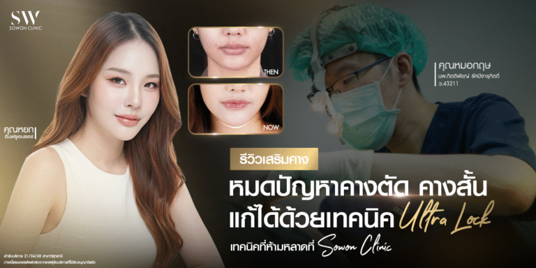 review-chin-surgery-ultra-lock_surgery-chin_review