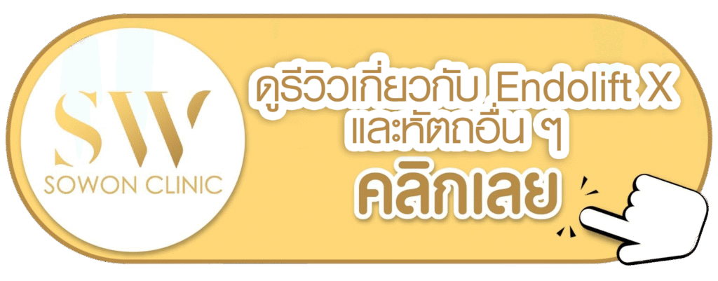 endolift_button_review