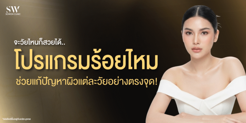 thread-lift-for-all-ages-skin-thread-knowledge