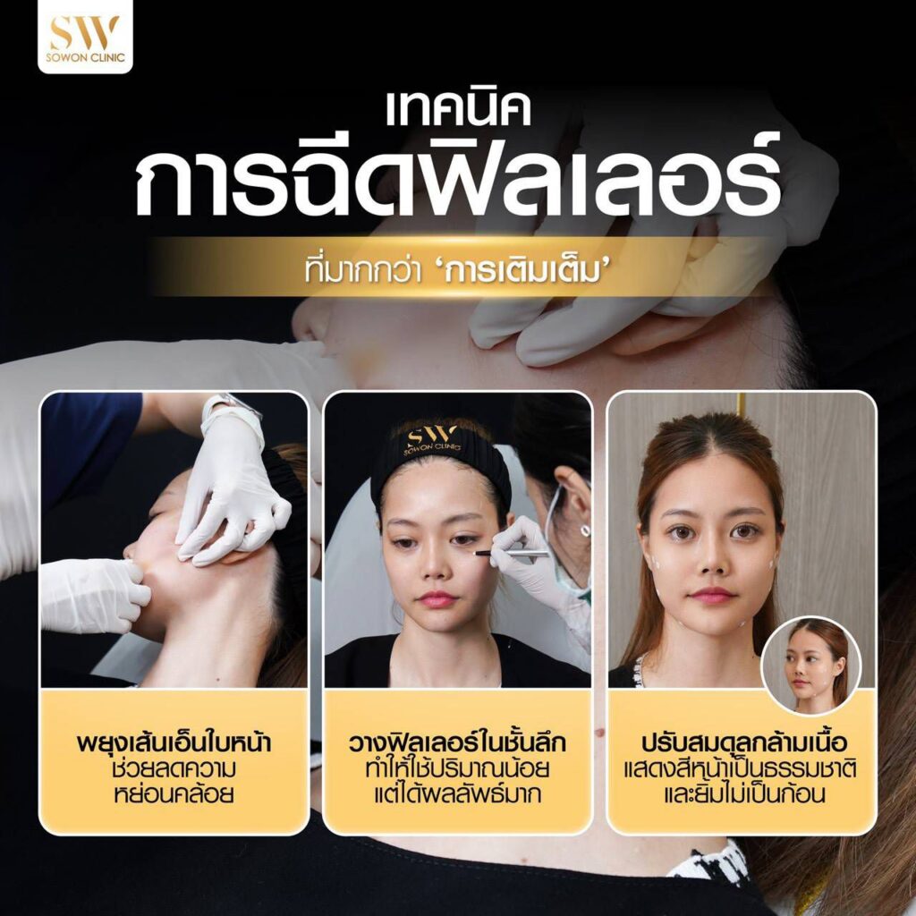 ฟิลเลอร์ 002