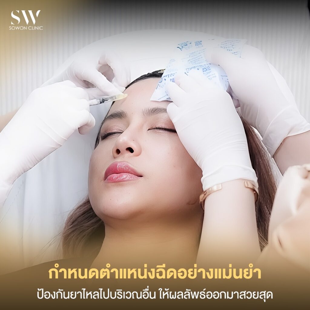 เทคนิคโบท็อกซ์ 02