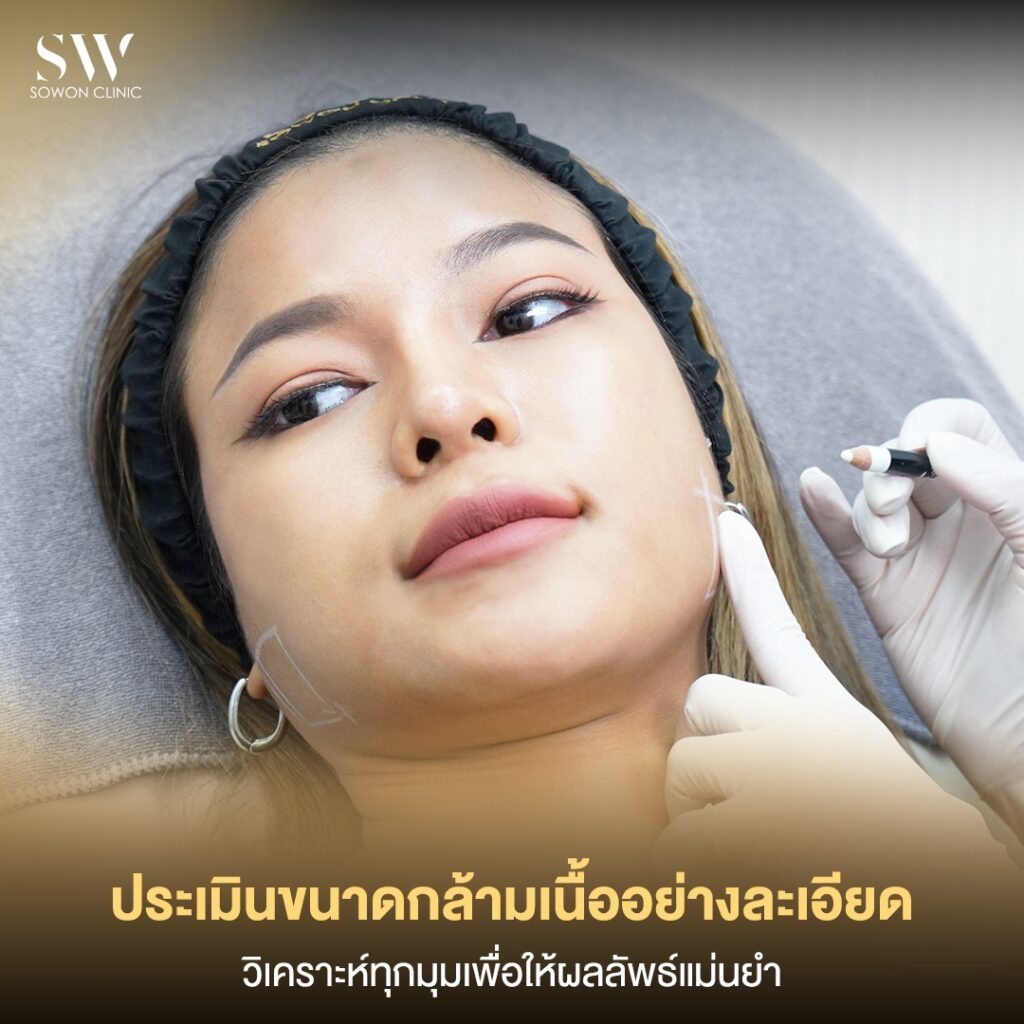 เทคนิคโบท็อกซ์ 03