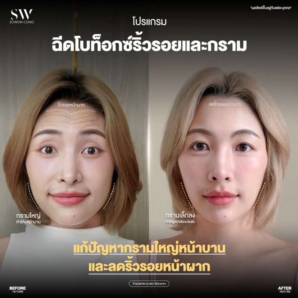 โบริ้วรอย / โบริ้วรอย