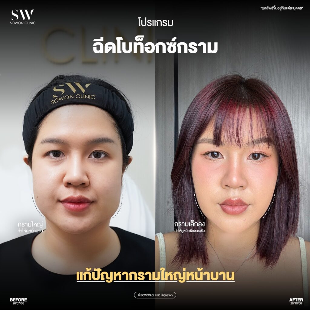 โบริ้วรอย / โบกราม