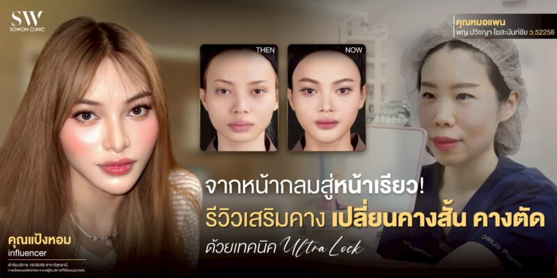 chin-augmentation-review-short-chin-ultra-lock-surgery-chin-review