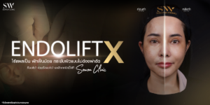 endolift-x-non-surgical-face-lift-skin-endoliftx-knowledge