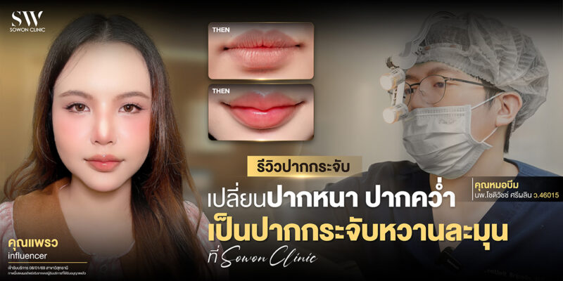 natural-cupid-bow-lip-surgery-surgery-lip-review