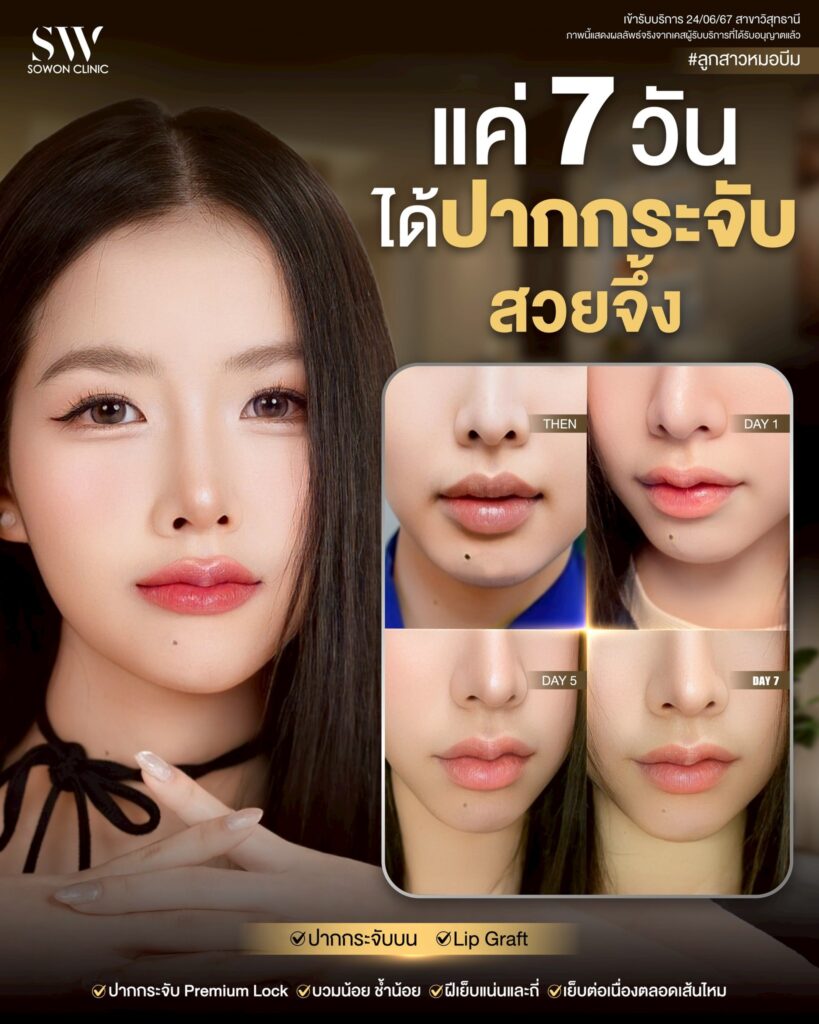ปากกระจับ 04