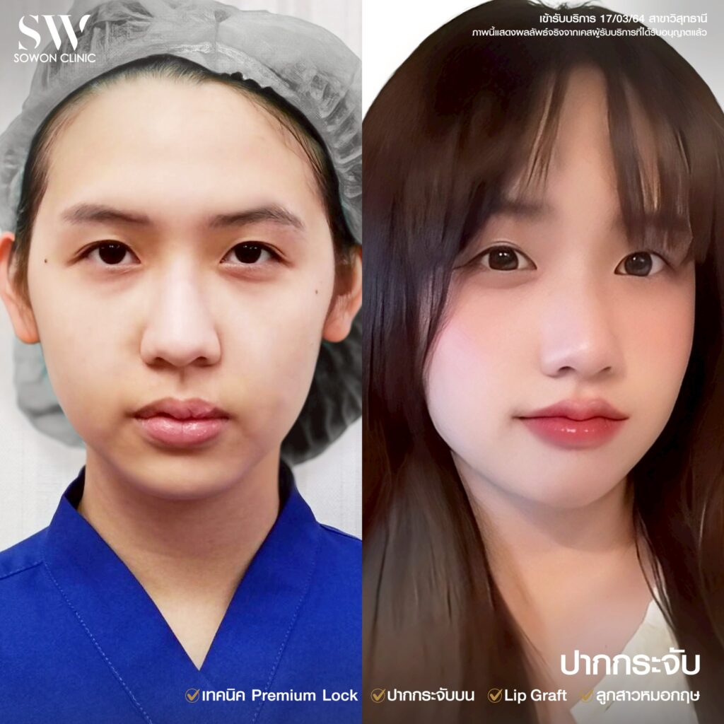 ปากกระจับ คุณกี้01