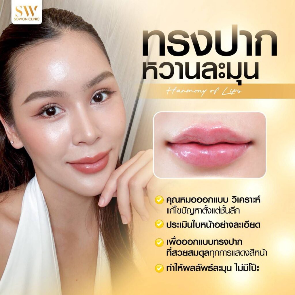 ฟิลเลอร์ คุณมะปราง 04