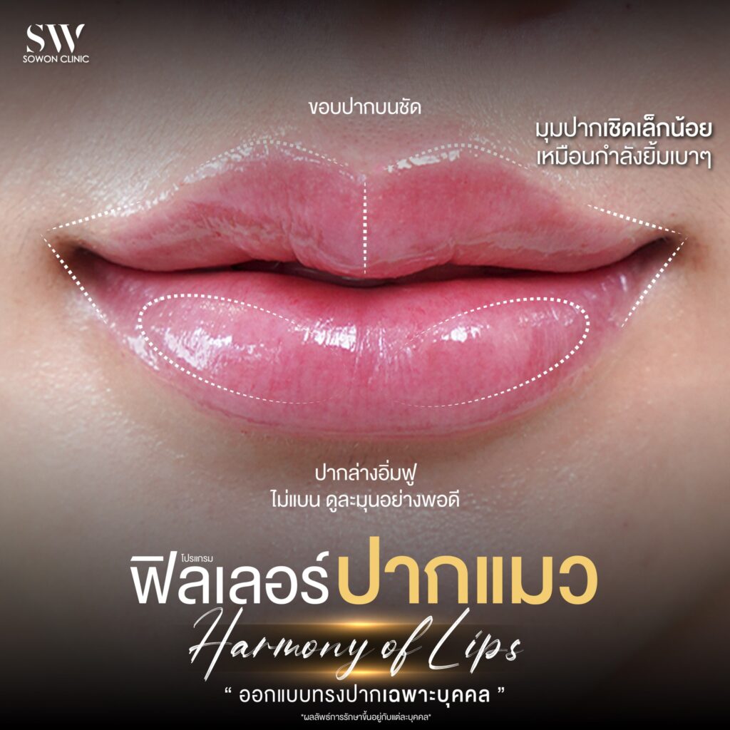 ฟิลเลอร์ปาก 07