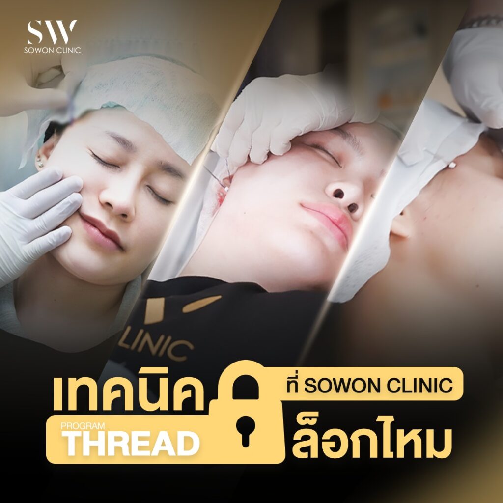 ร้อยไหม 01