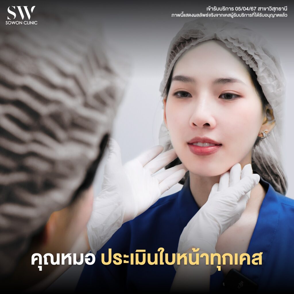 เสริมคาง 11