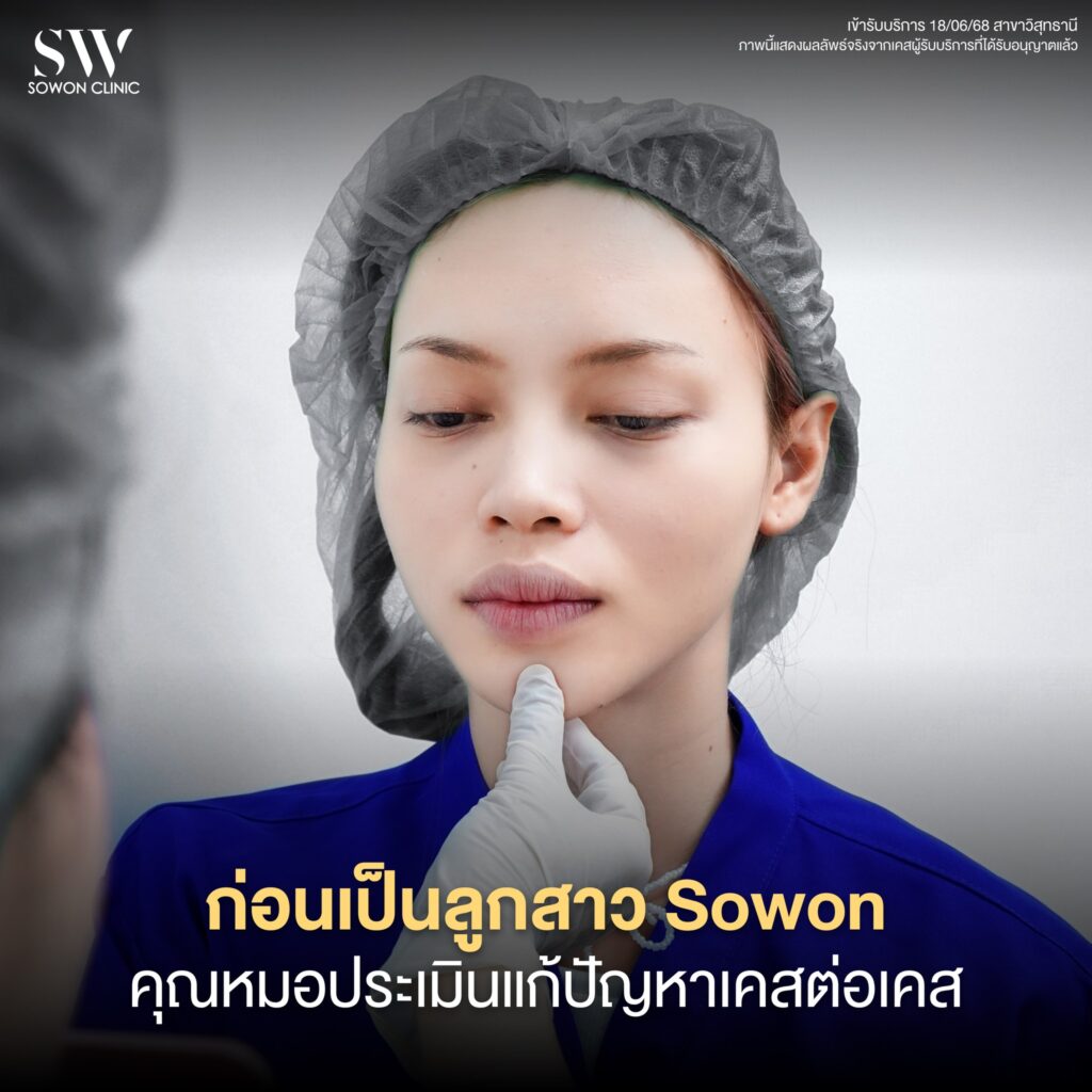 เสริมคาง คุณแป้งหอม 02