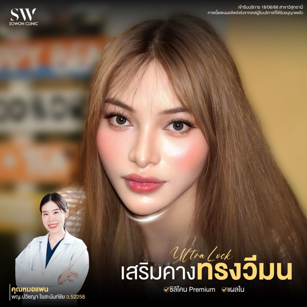 เสริมคาง คุณแป้งหอม 06