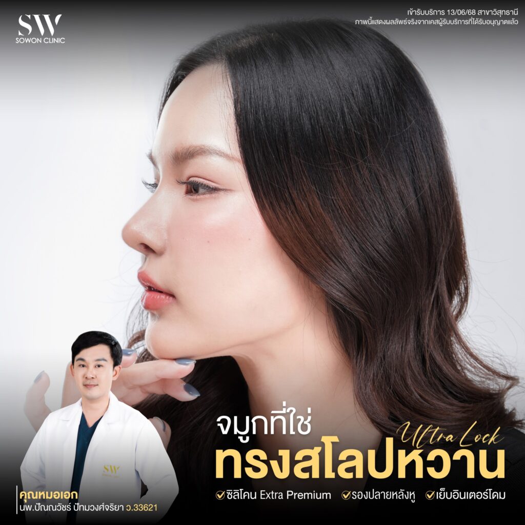 เสริมจมูกครั้งแรก 02