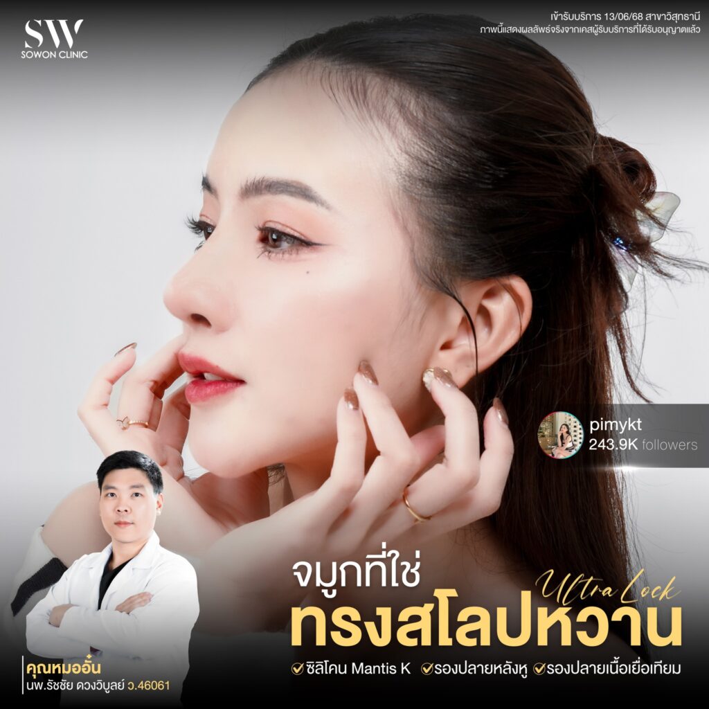 เสริมจมูกครั้งแรก 03