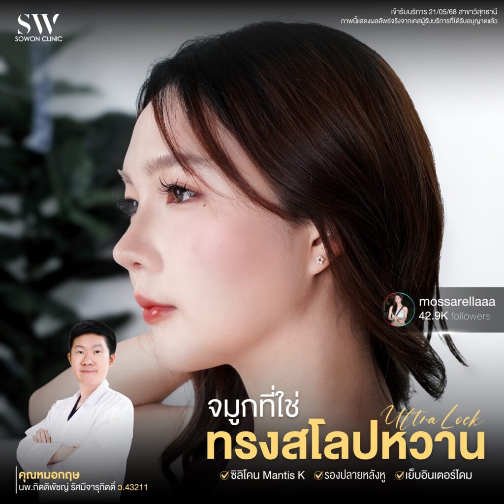 เสริมจมูกครั้งแรก 04