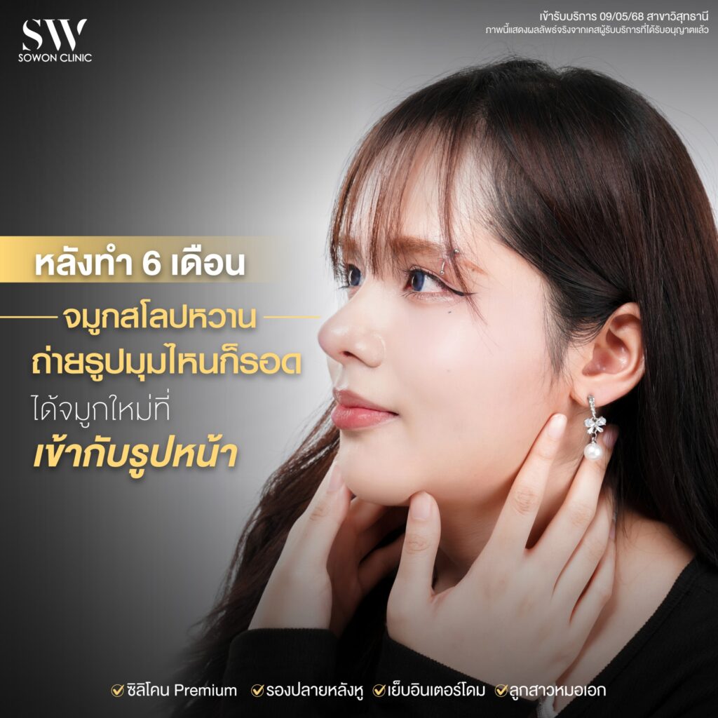 เสริมจมูกครั้งแรก 06