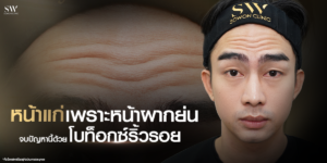botox-for-forehead-wrinkles__skin-botox_knowledge