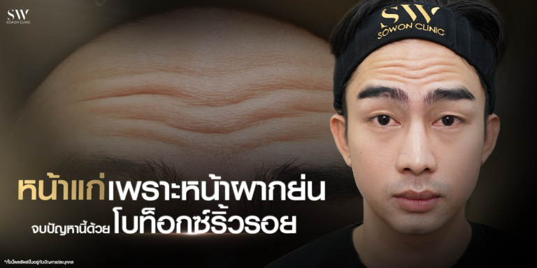 botox-for-forehead-wrinkles__skin-botox_knowledge