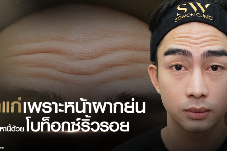 botox-for-forehead-wrinkles__skin-botox_knowledge botox-for-forehead-wrinkles__skin-botox_knowledge