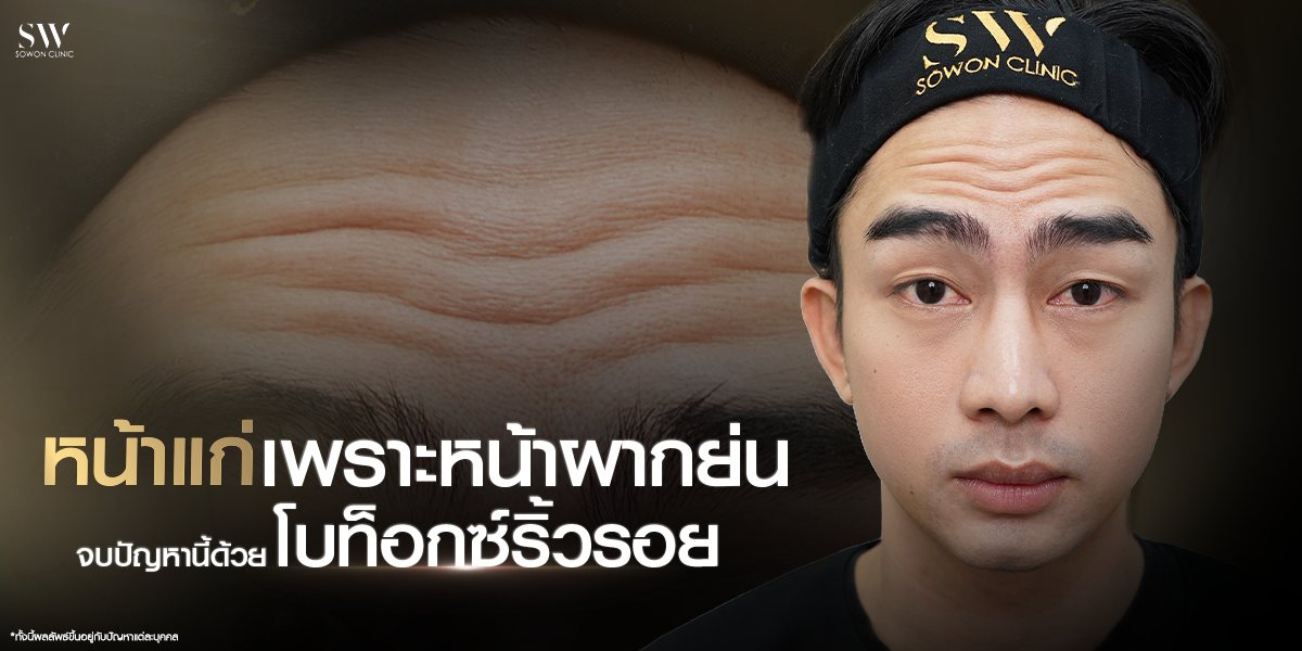 botox-for-forehead-wrinkles__skin-botox_knowledge botox-for-forehead-wrinkles__skin-botox_knowledge