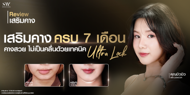chin-augmentation-7-months-review_surgery-chin_review