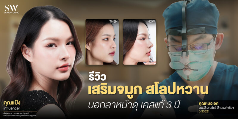 rhinoplasty-review-sweet-slope-revision_review-surgery-nose-review