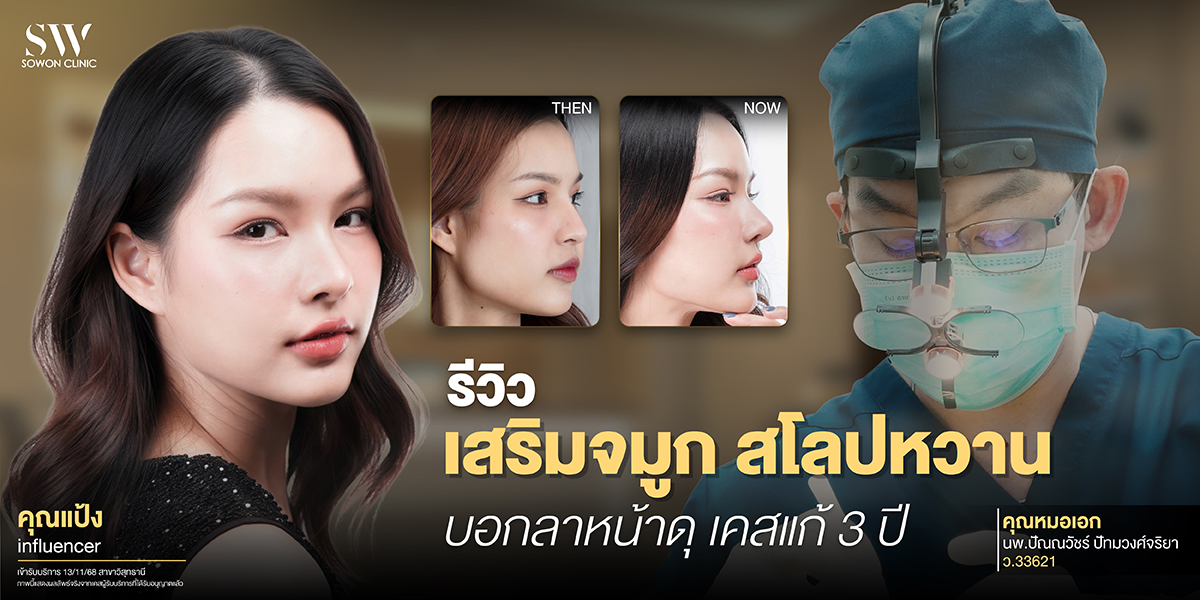 rhinoplasty-review-sweet-slope-revision_review-surgery-nose-review rhinoplasty-review-sweet-slope-revision_review-surgery-nose-review