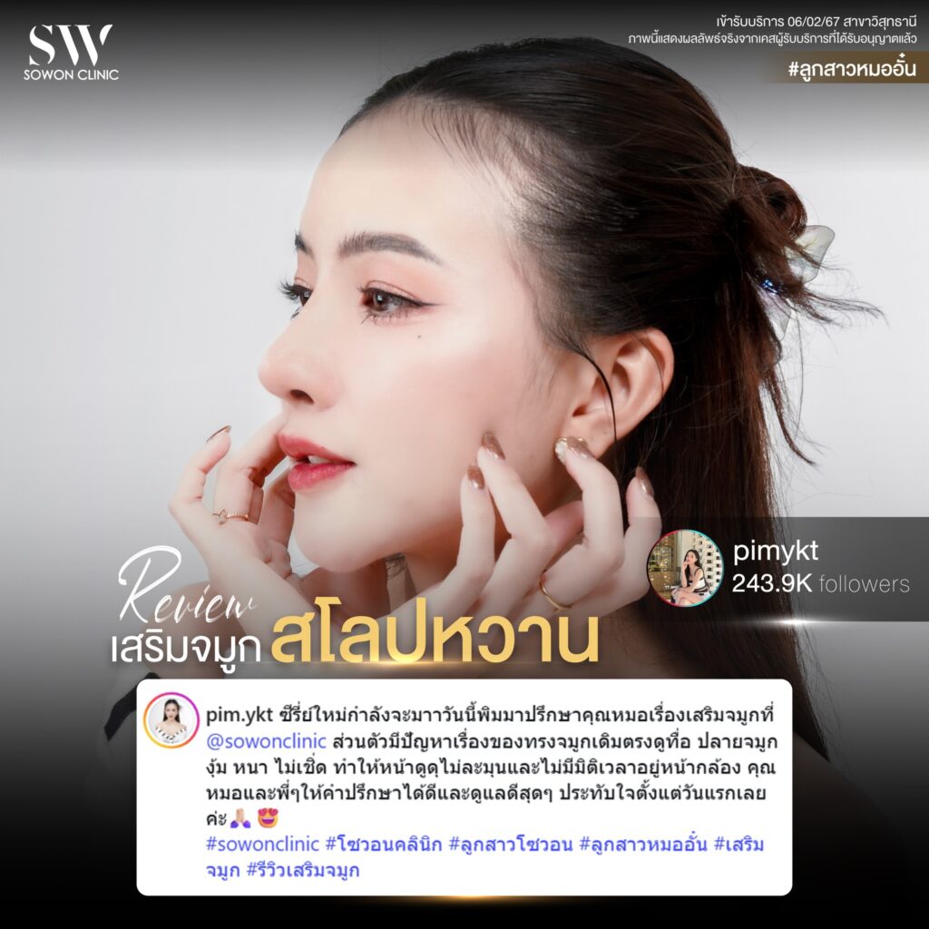 เสริมจมูก 01