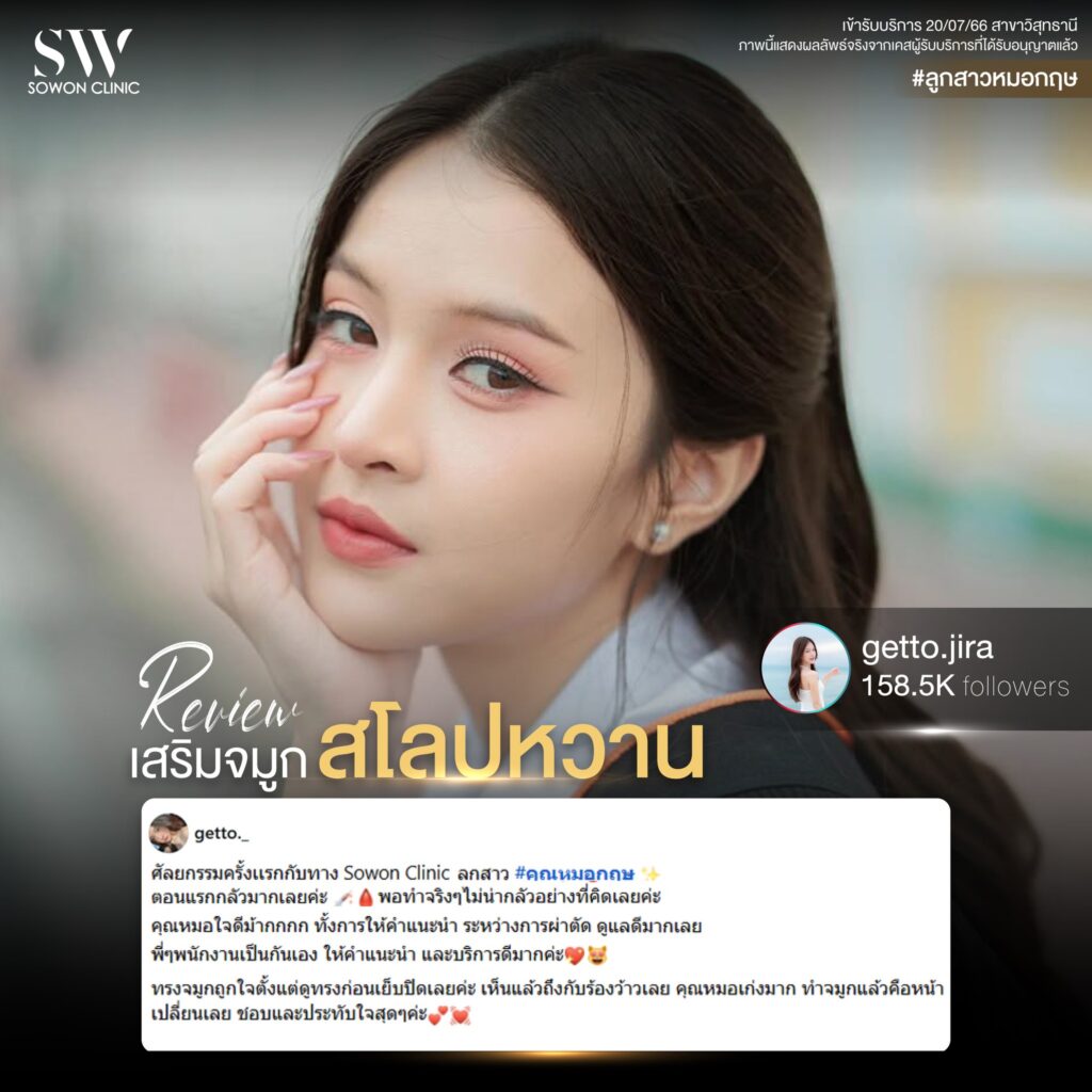 เสริมจมูก 02