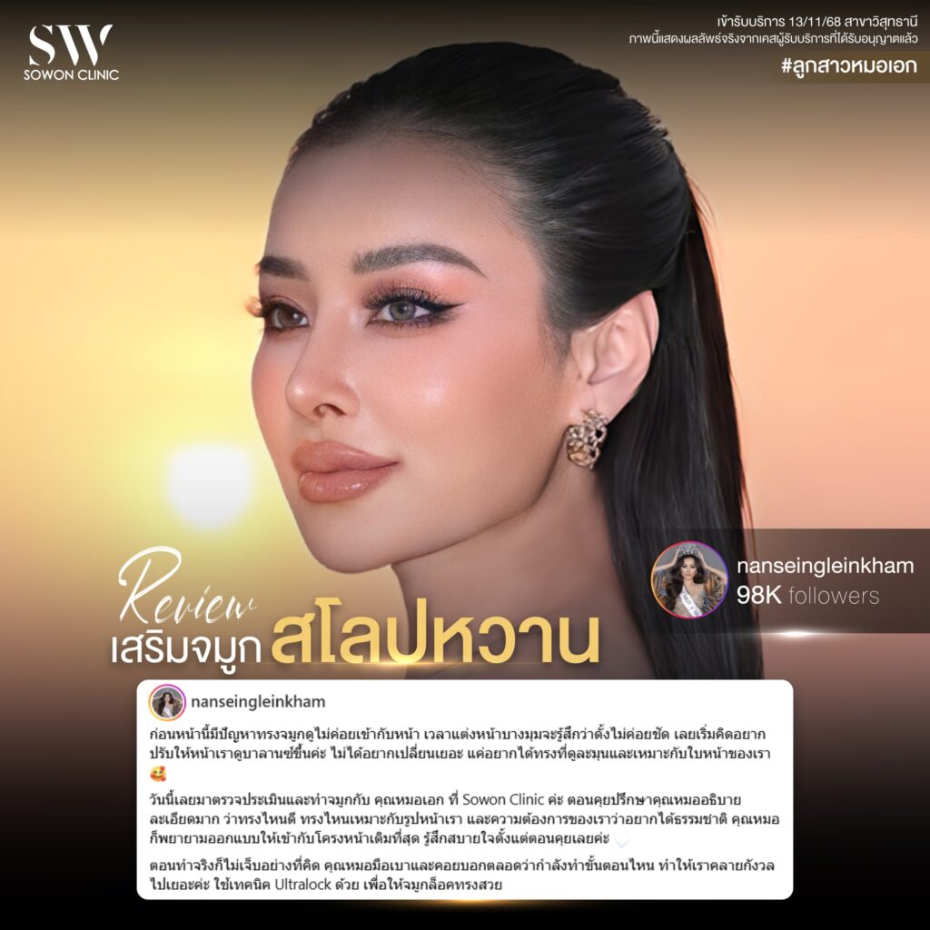 เสริมจมูก 03