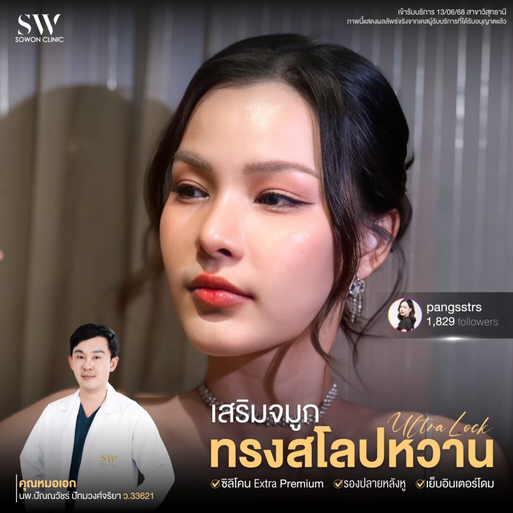 เสริมจมูก 14