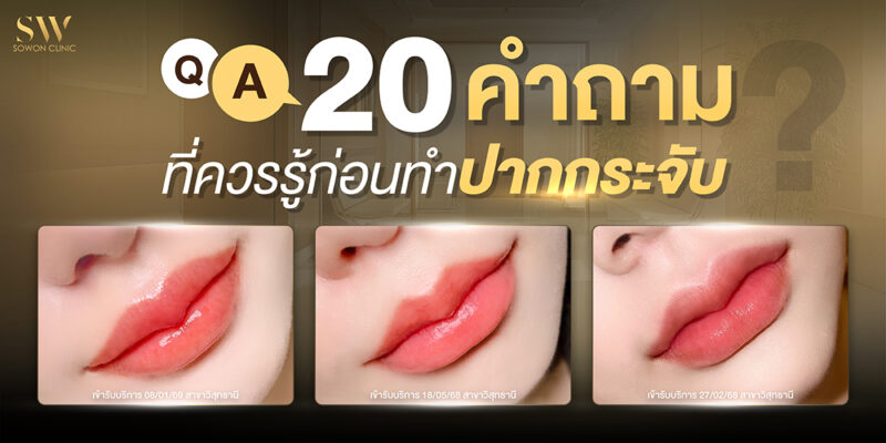 Q&A 20 คำถาม ที่ควรรู้ก่อนทำปากกระจับ