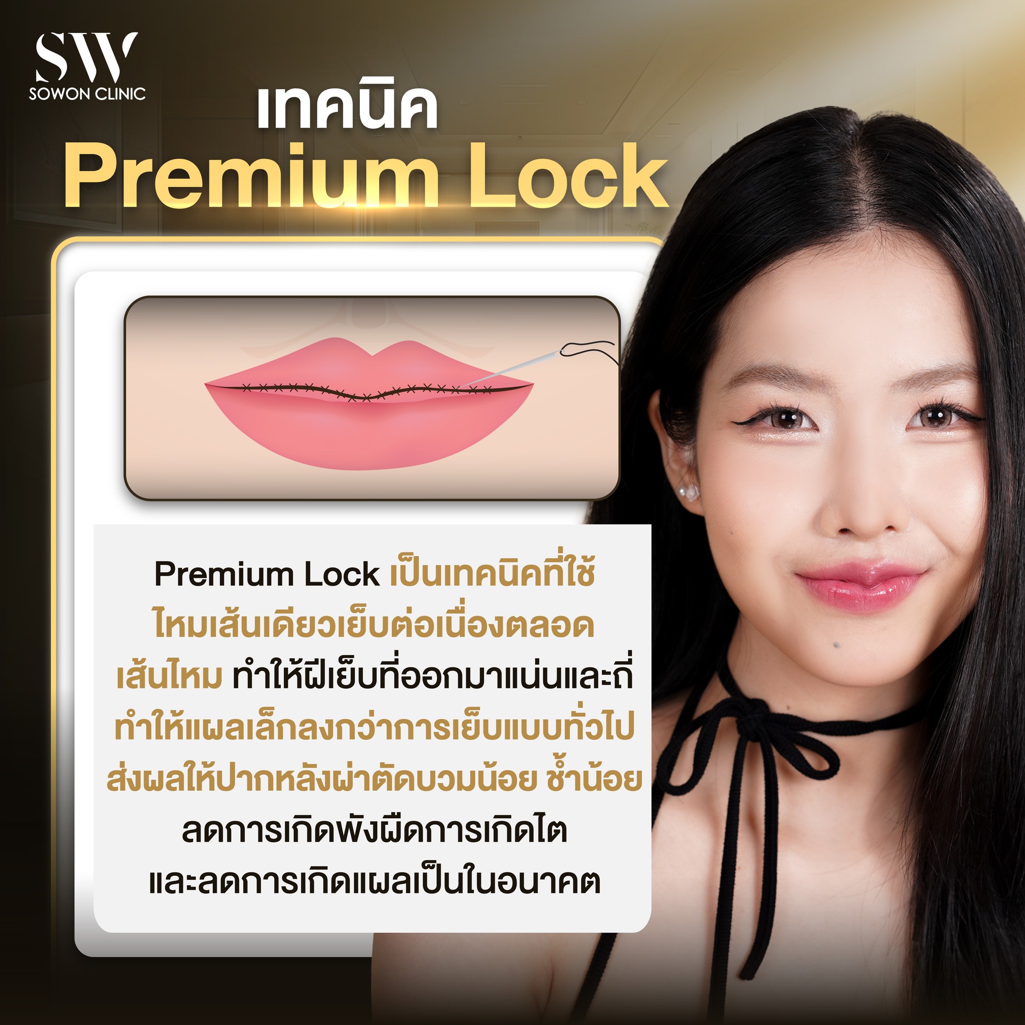 ปากกระจับ Premium lock