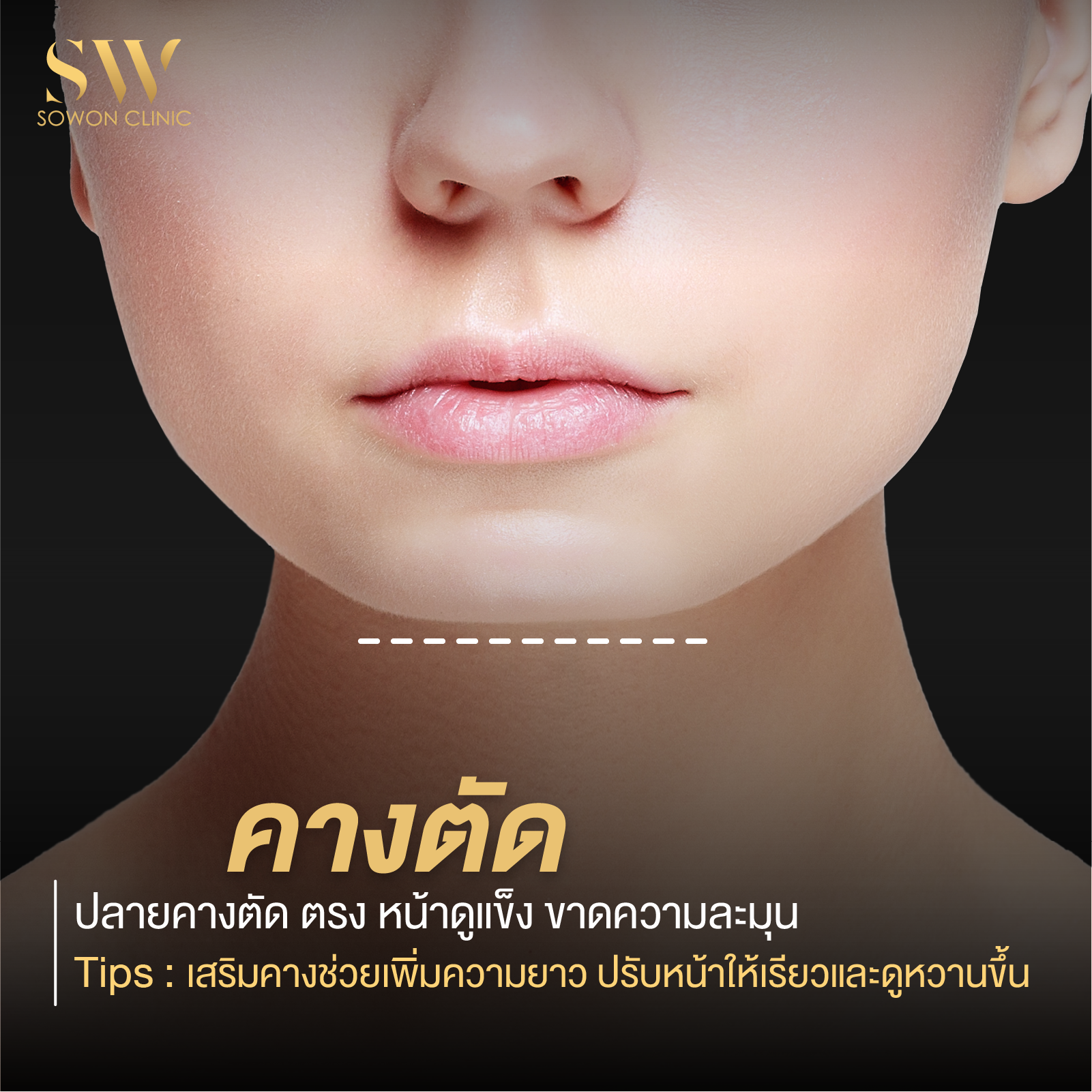 เสริมคาง คางตัด